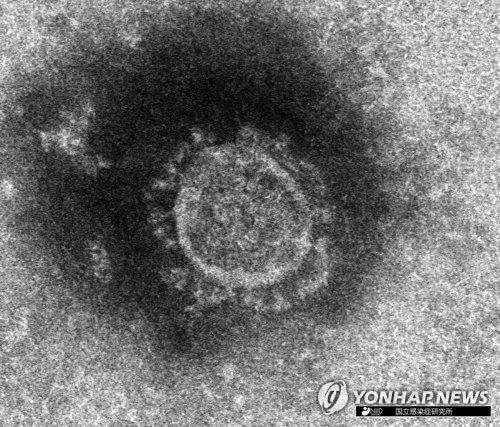 코로나바이러스 전자현미경 사진