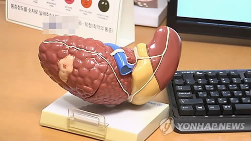 지방간 환자 42% 진단 후 사실상 방치... 당뇨&middot;비만 고위험군 정밀 검사율 12% 불과