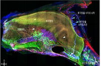 250年の脳の難問を解明…認知症治療の『第一関門』を発見