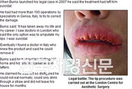 피트 번즈 성형부작용으로 9억 배상