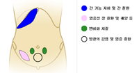 꾹 눌러만 봐도 ‘건강이’ 잡힌다