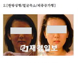 침만으로 얼굴이 작아진다?