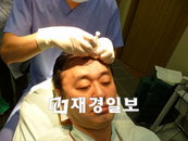 모발이식 수술, 머릿결 잡아주는 기술도 경쟁력