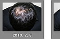 탈모 방지 위해 금연은 필수!