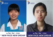 화상소녀 탄휘린, 한국서 웃음 되찾는다