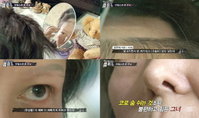 '돈 새는 관상'1박 2일동안 성형한 여인 참혹한 결과