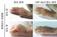 국내 연구진, 류마티스 관절염 원인유전자 밝혀내…치료제 개발 기여할 듯