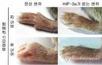 국내 연구진, 류마티스 관절염 원인유전자 밝혀내…치료제 개발 기여할 듯