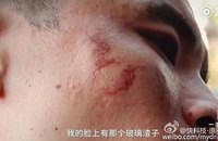 애플 아이폰7, 中서 폭발 주장 제기···삼성 갤노트7 이어 위기 맞나