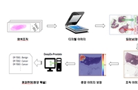 정부, 딥바이오 전립선암 진단 AI 의료기기 허가...암 분야서 최초