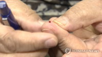메트포르민 발암물질 관련 '5문 5답'