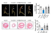 카이스트, 나노미터급 약물로 동맥경화증 효과적 치료 기술 개발