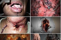 달라지는 담뱃갑 그림…12월부터 적용