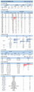 28일 국내 코로나19 발생현황 (71명 추가)