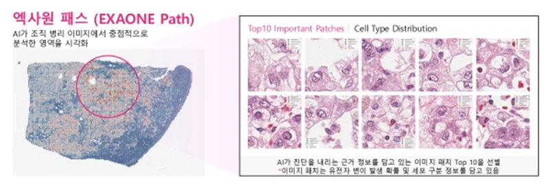 의료 AI 모델 '엑사원 패스 2.0' [LG AI연구원 제공]