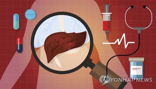 바이오사이언스 간암 1차 치료, 생존 2년 벽 넘본다
